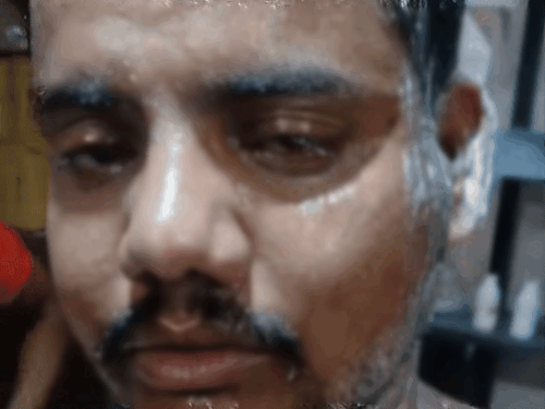 घायल गोपाल ने बताया कि वह घर के बाहर खड़ा था। लेन-देन और बंटवारे को लेकर विवाद है।