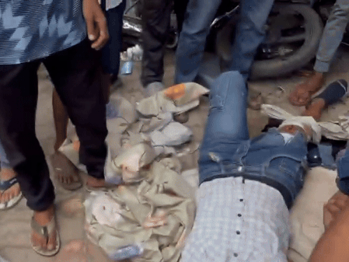 गाड़ी की टक्कर लगने के बाद जमीन पर पड़ा युवक। इसके पैर में चोट लगी है।