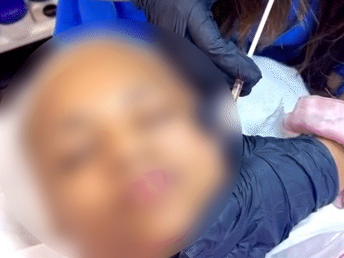 इंस्टाग्राम प्रोफाइल पर अपलोड वीडियो में युवती पीआरपी ट्रीटमेंट देती हुई नजर आ रही है।