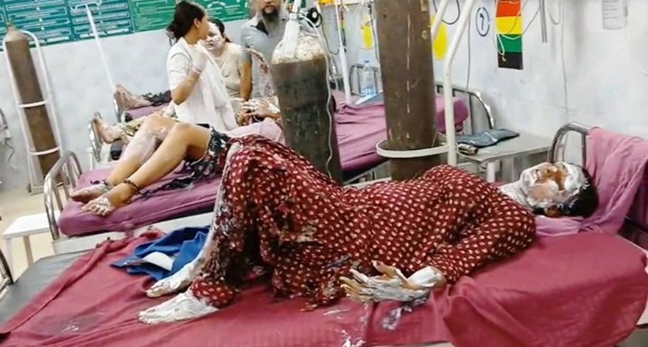 अस्पताल में भर्ती आग में झुलसी महिला।