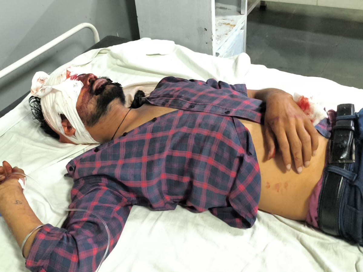 अस्पताल में एडमिट बाइक चालक।