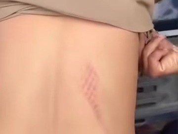 The video shows belt marks on the constable's back.