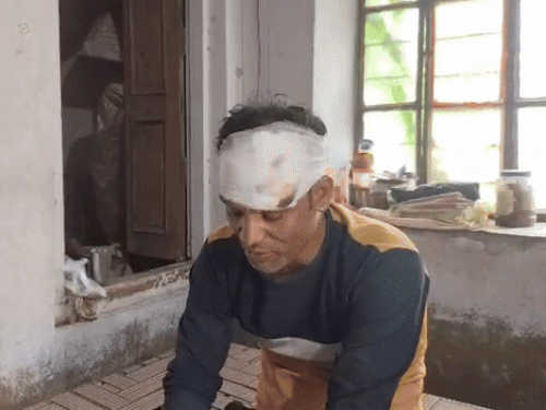 सांड के हमले के बाद मिथुन भोजक बेहोश हो गया था। सिर और पैरों में गंभीर चोटें आई है।