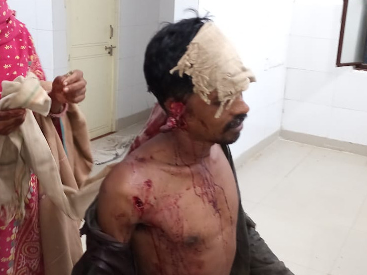फलासिया के सामुदायिक स्वास्थ्य केंद्र में इलाज के बाद घायलों को उदयपुर लाया गया।