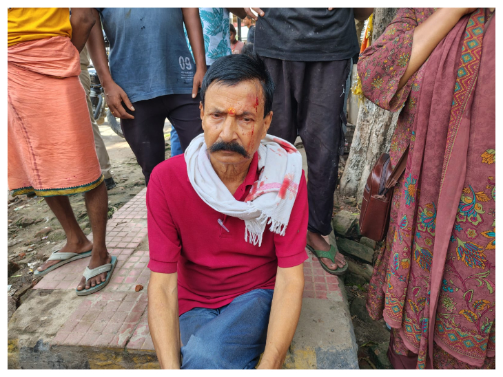 The Congress worker suffered a head injury in the fight.