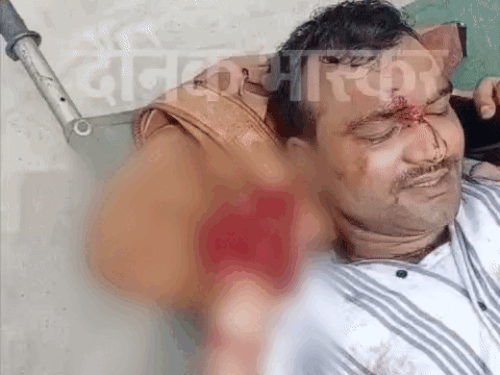 लुधियाना में रेलवे यात्री की कटी दोनों लात:  फौजी का लुटेरों ने झपटा मोबाइल,मुकाबला करते समय रेल गाड़ी के चपेट में आया – Ludhiana News