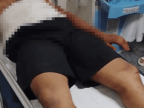 फरीदाबाद में दूध बांटने जा रहे युवकों पर हमला:  चाकू और ब्लेड मारकर किया घायल , अमूल का दूध लेकर जा रहे थे – Faridabad News