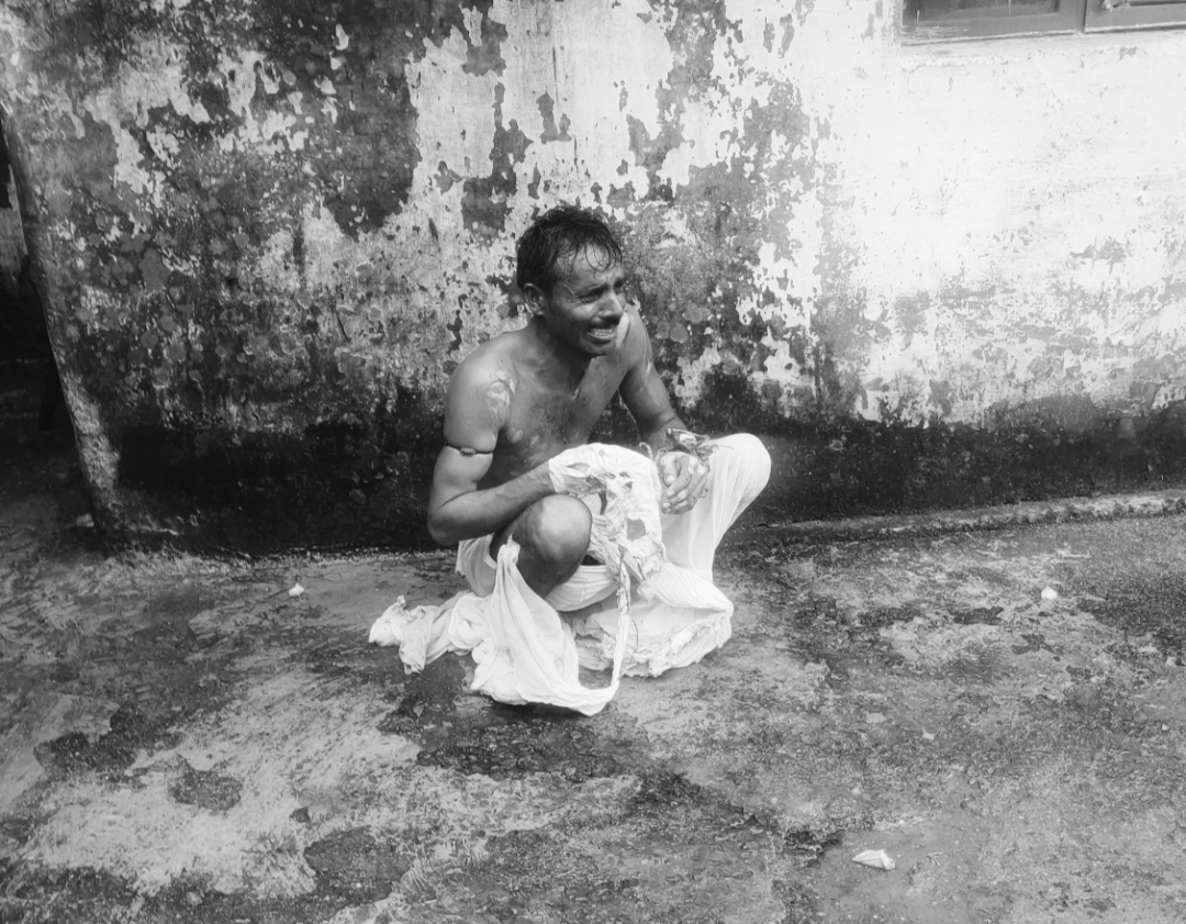 आरक्षक के क्वार्टर के सामने जली अवस्था में चंदन। फाइल फोटो।