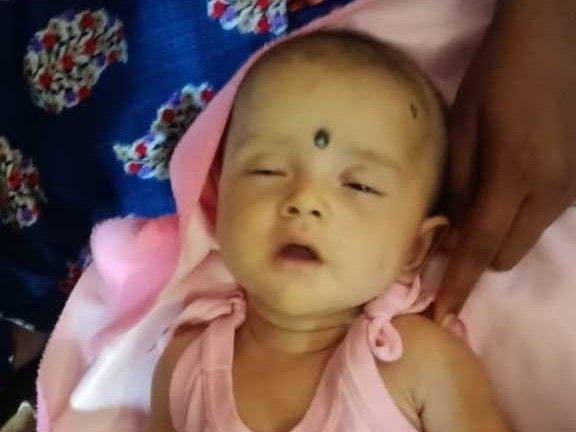 2 महीने की नवजात बच्ची की टीकाकरण के बाद मौत।