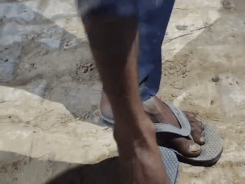 Villagers showing complaints of allergy at the foot