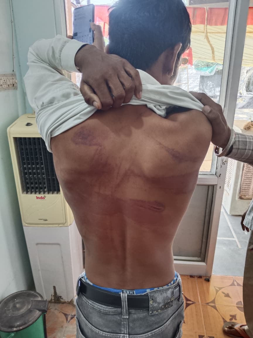 मारपीट से युवक के पीछे काफी निशान दिखाई दिए।