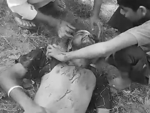 आरोपियों ने मोहित के सिर पर वार किया। जिससे वह लहूलुहान हालत में जमीन पर गिर गया।