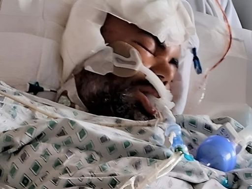 Vikas is a photo of this photo when he was hospitalized in the US hospital in an injured state.