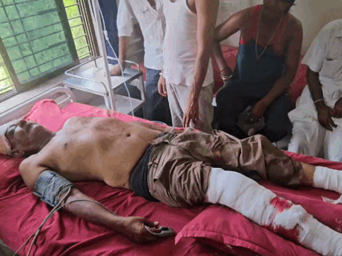 निजी बस के ड्राइवर का अस्पताल में इलाज जारी है।