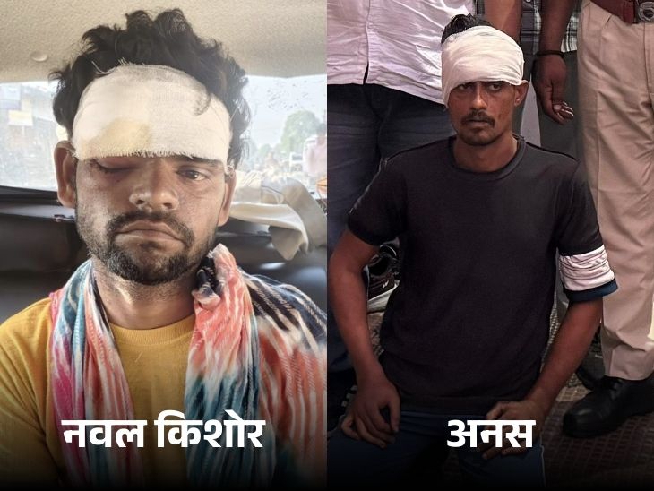 जेल से भागने के बाद दोनों बंदियों के सिर में चोट आई। पहले दीवार से गिरे। फिर बाइक से गिरे।