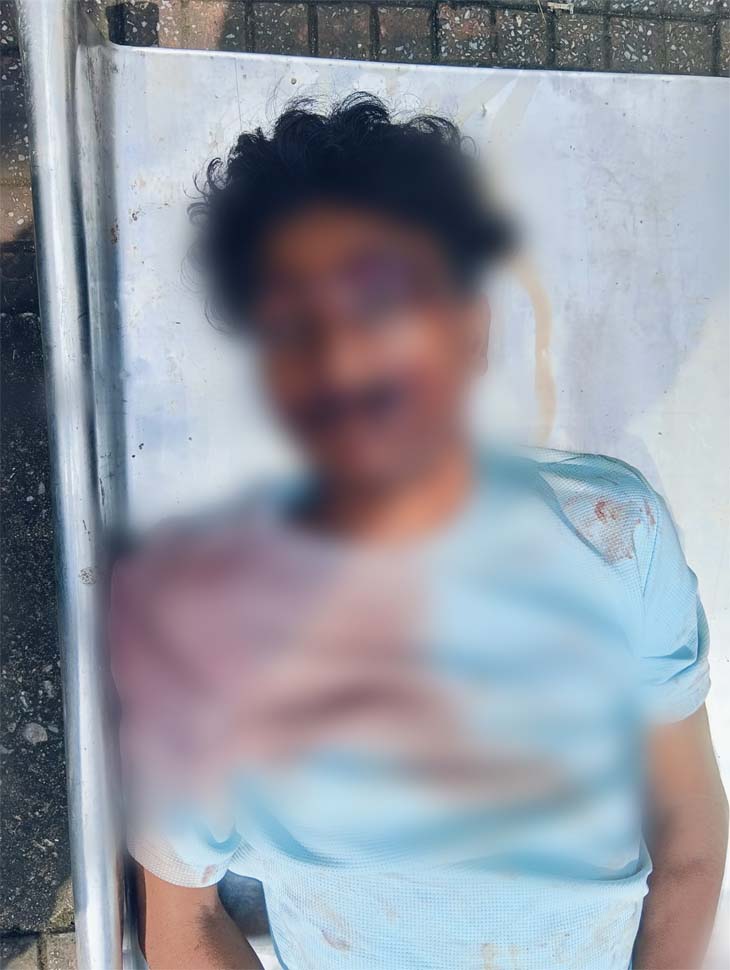 पंकज महंत गाड़ी चला रहा था, जिससे उसके माथे और शरीर के अन्य हिस्से में चोट आई।