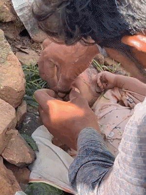 The child started crying after removing the stone from the mouth.