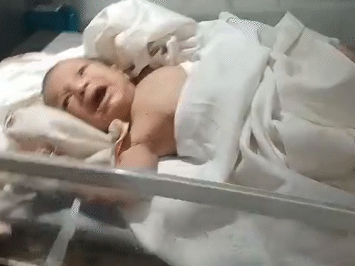 After investigation and first aid at the Deputy District Hospital of Bijoulia, the child was referred to the Higher Center in Bhilwara.