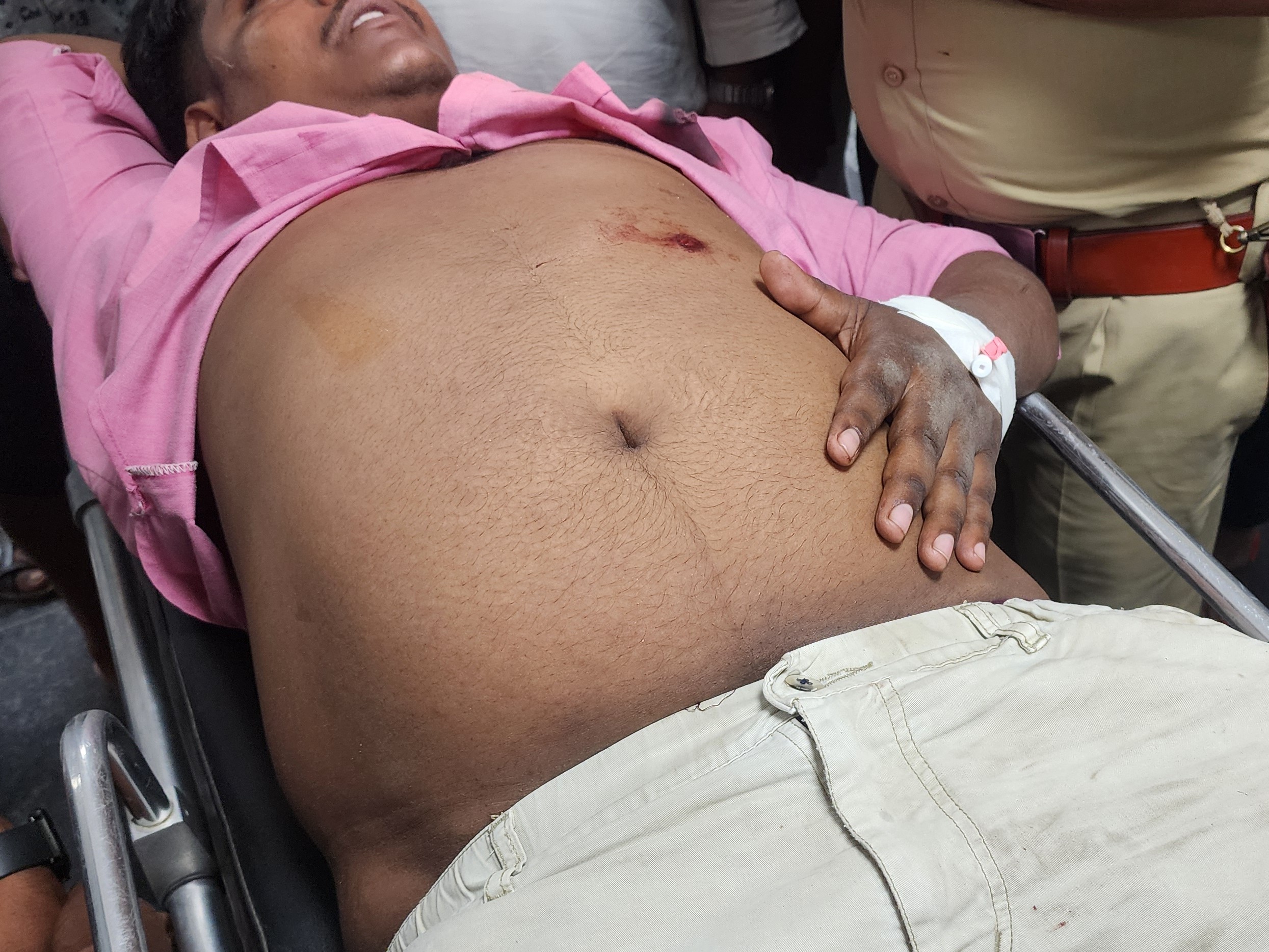 सीवान में बाइक सवार बदमाशों का हमला:  युवक को पेट में मारी गोली, पटना रेफर – Siwan News