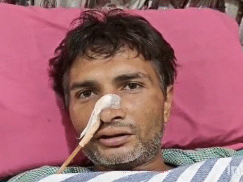 The young man swallowed things in protest against drug addiction. | यूपी  में युवक 29 स्टील चम्मच, 19 टूथब्रश निगल गया: डॉक्टरों ने 5 घंटे ऑपरेशन कर  50 चीजें निकालीं; मरीज बोला-