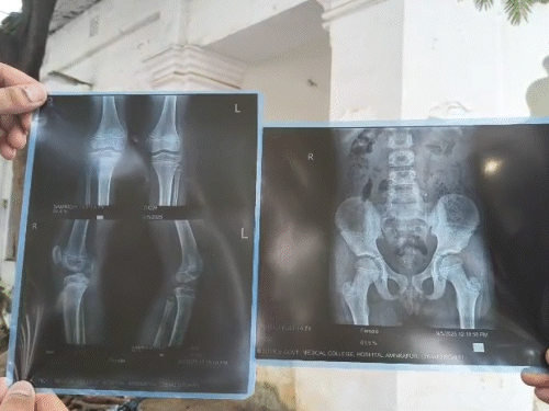 This is an X-ray of the baby's feet.
