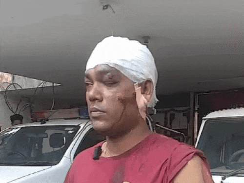 हादसे में घायल हुआ अखबार बांटने वाला युवक दीपक।