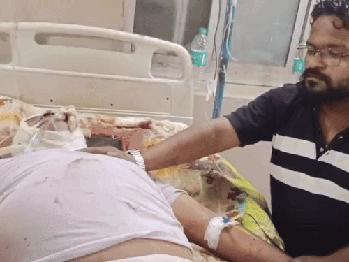 एमबीएस हॉस्पिटल में भर्ती घायल बाबूलाल