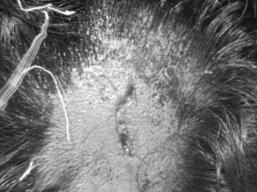 लुधियाना में झगड़े के बहाने हमला:  खून से लथपथ युवक से सोने की चेन व नकदी लूटी – Ludhiana News