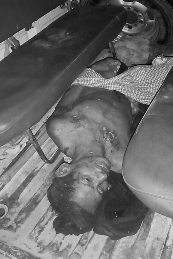 सीने से लेकर जांघ तक बाघ ने किशुन पर किया हमला।