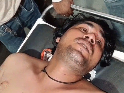 हमले में जुबेर(35) के कंधे पर छर्रा लग गया। घायल हालत में अलवर के जिला अस्पताल लाया गया।