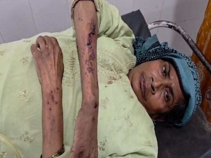 घायल जुबेदा जूबेर की मां