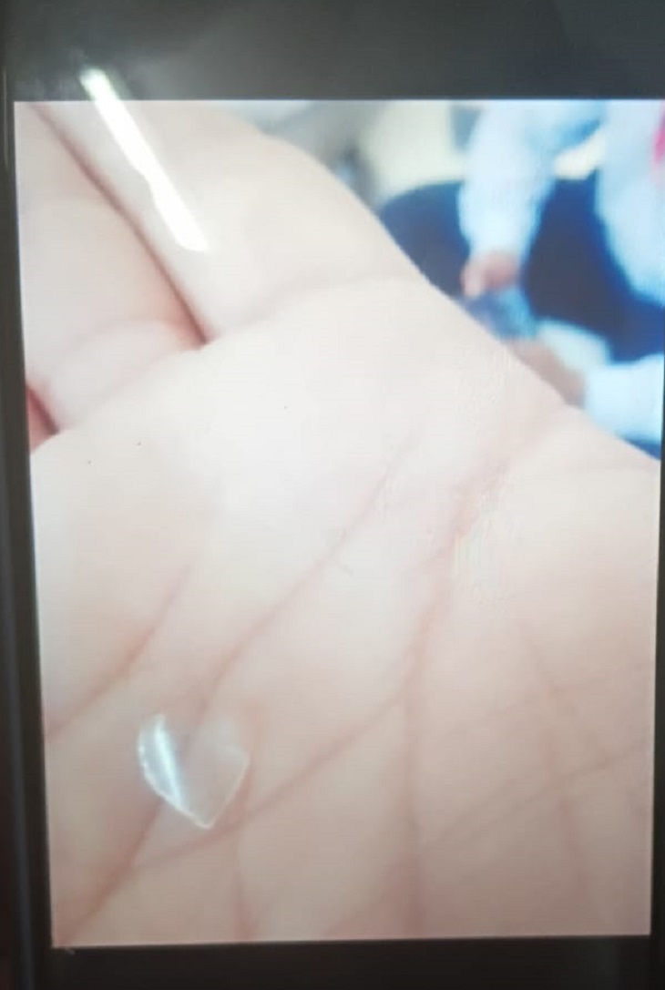As soon as a piece of glass came out of Gulab Jamun, staff workers took a photo of it. After this, the officers complained.