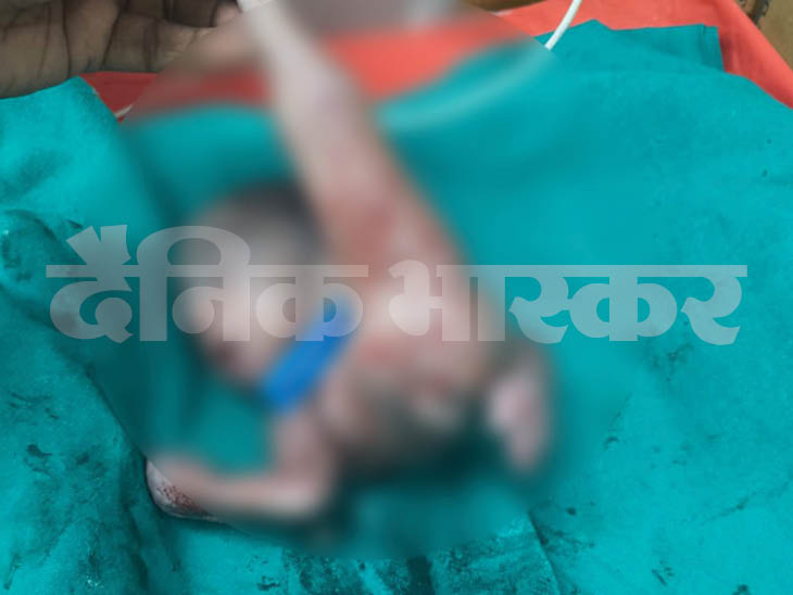 The newborn's two legs were connected.