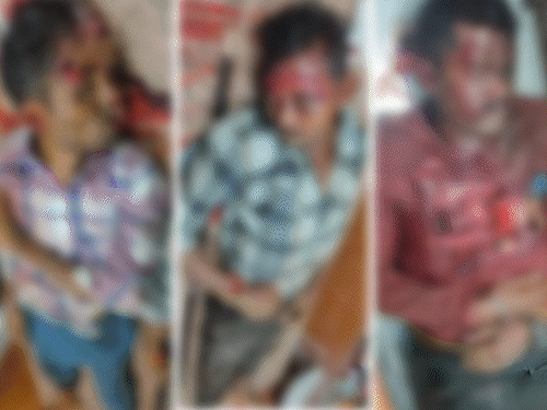 धमतरी में सड़क हादसे में एसटीएफ जवान समेत 3 दोस्तों की मौत हो गई। हादसे के बाद की तस्वीर है। - Dainik Bhaskar