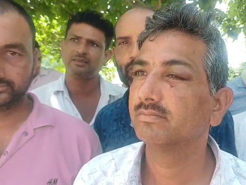 कर्मचारी की आंख और पीठ में चोट आई है।