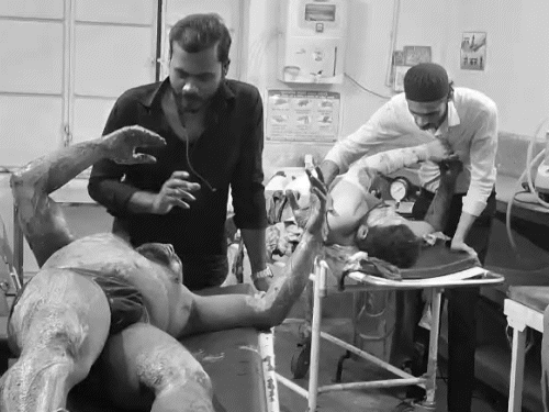 विस्फोट से घायल हुए लोगों को उर्सला अस्पताल में भर्ती कराया गया।
