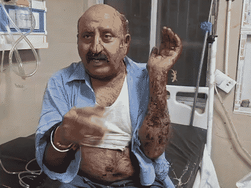 धमाके में ग्राहक घायल हो गए, वह बाजार में सामान लेने गए थे।