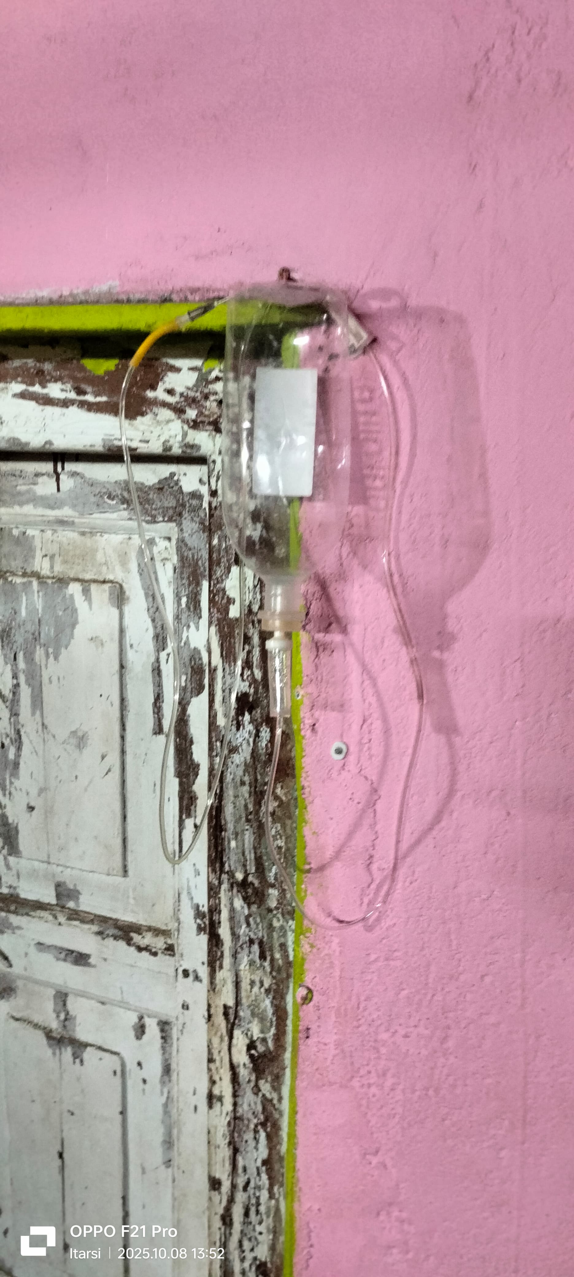 इस तरफ सिरेंज बोतल लगाई जा रही।