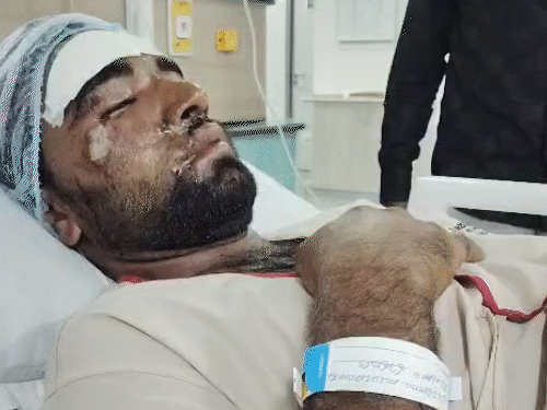 सद्दाम का अभी अस्पताल में इलाज जारी है।