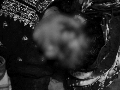 This is Maulana's wife Israna, who was bleeding from her head.