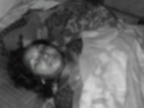 कोरबा में पति ने पत्नी की गला घोंटकर की हत्या, फिर फांसी लगाकर जान दी। - Dainik Bhaskar