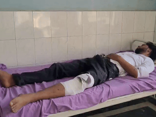 दोनों शूटरों को गुरुग्राम में सिविल अस्पताल के कैदी वार्ड में भर्ती कराया गया है।