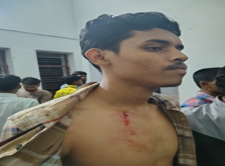 चोट का निशान दिखाता हुआ छात्र।