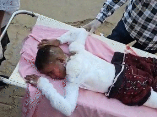 आग लागताच बसचा दरवाजा लॉक झाला: प्रत्यक्षदर्शी म्हणाला- सैन्याने जेसीबीने गेट तोडले, आत मृतदेह होते; सामान्य बस मॉडिफाइड करून एसी बस केली होती या अपघातात मुलेही भाजली होती, ज्यांना गंभीर अवस्थेत जोधपूर येथे रेफर करण्यात आले.