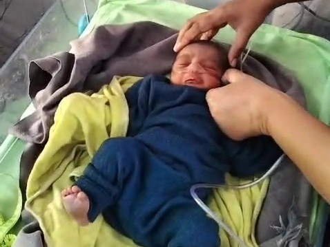 बच्चे का अस्पताल में इलाज जारी है।