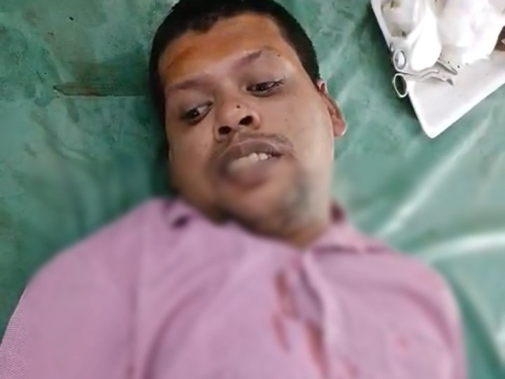 देवेश सिंह का अभी अस्पताल में इलाज चल रहा है।