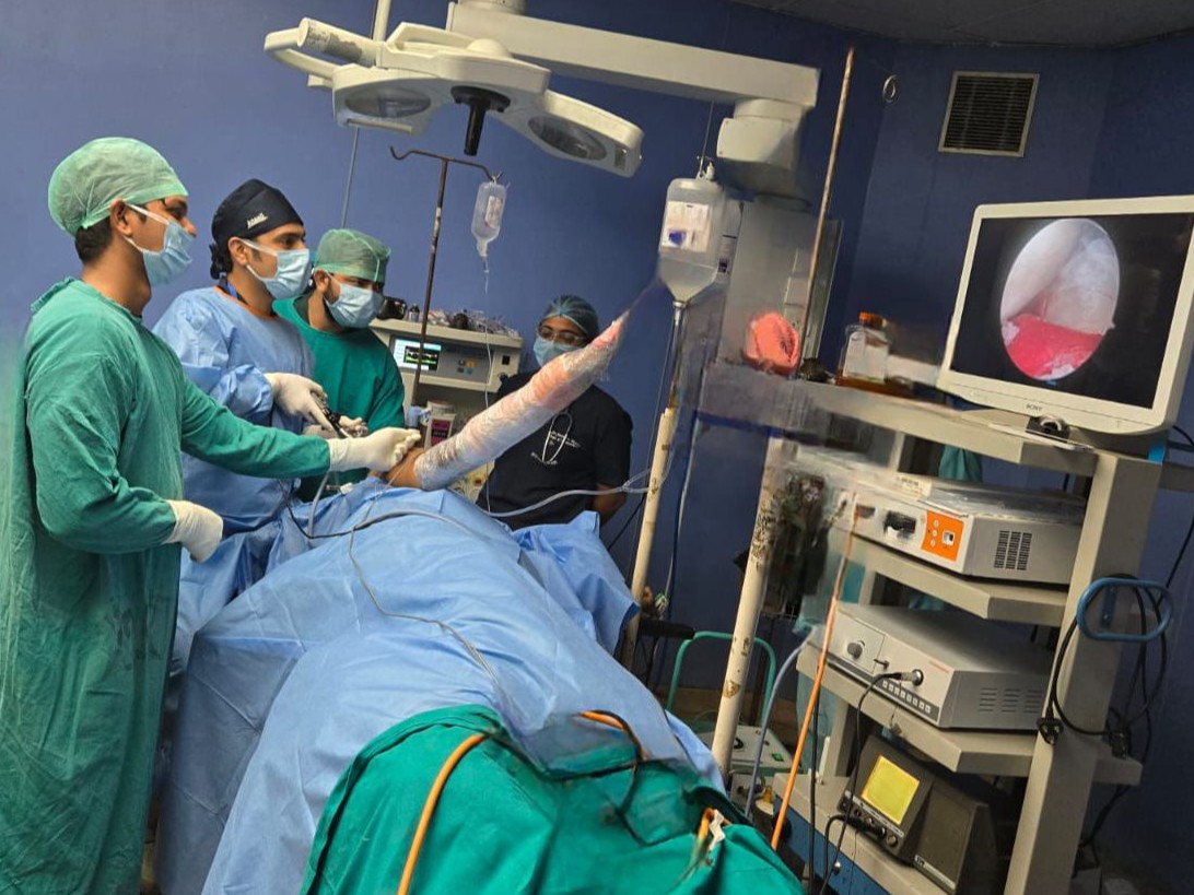 Advanced Shoulder Arthroscopic Surgery at SNMC | SNMC में हुई एडवांस्ड ...