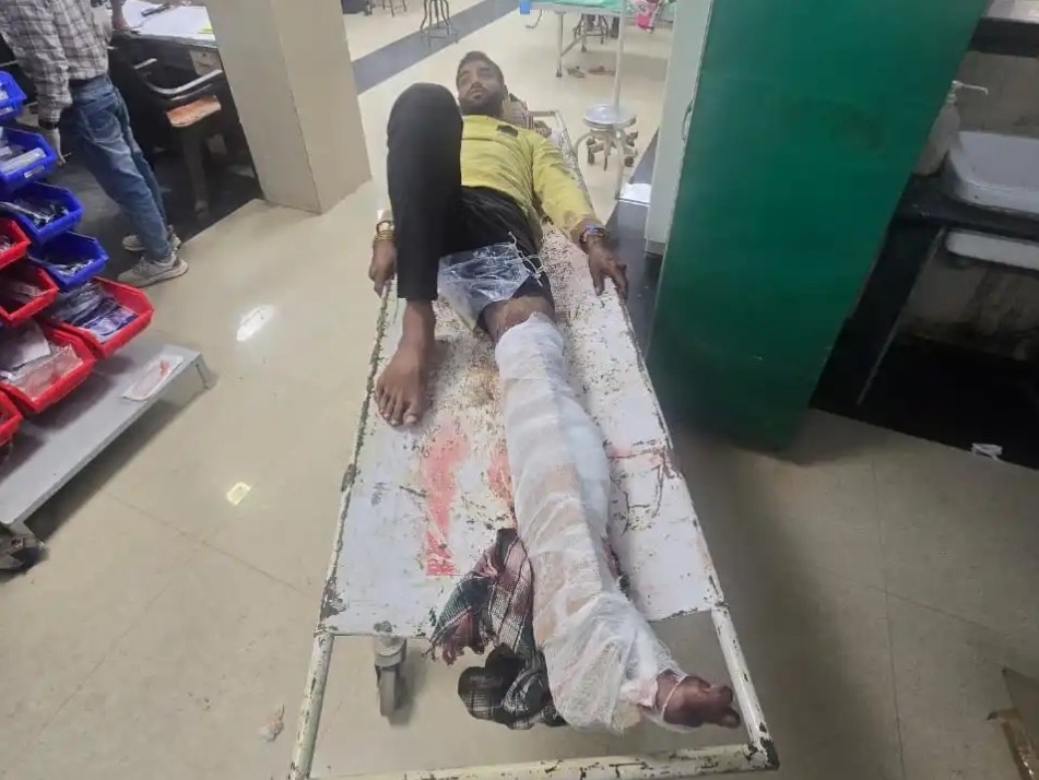 घायल ड्राइवर को रायपुर रेफर किया गया है।