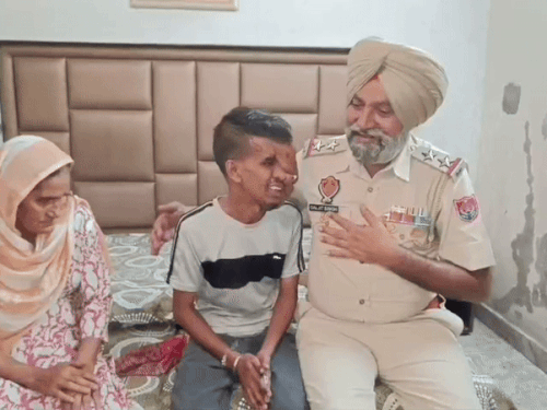 अमृतसर का टिंकू ट्यूमर से पीड़ित:  डेढ़ साल में बीमारी शुरू हुई, आंख गंवाई, चेहरा बिगड़ा, इलाज नहीं मिला, कूड़ा बीनने को मजबूर – Amritsar News