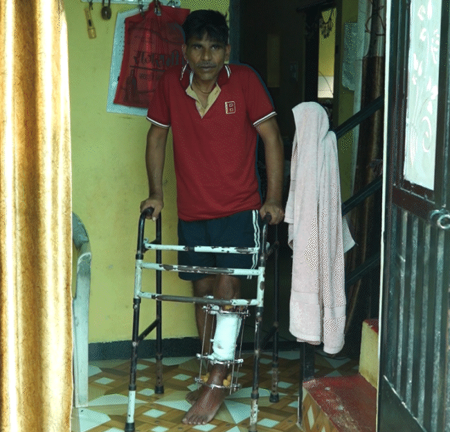 पिछले 20 महीने से दिनेश का पैर ठीक ही नहीं हुआ है। इलाज जारी है।